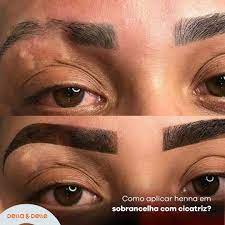 Sobrancelha Perfeita: Tira Manchas e Erros com o Removedor La Benig 30mL